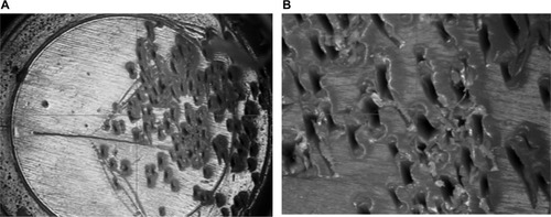 Figure 1 Magnified view of the plastic Port base; (A; ×21) and (B; ×147).