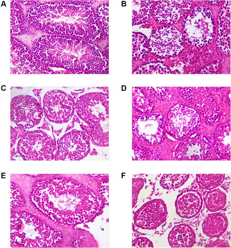 Figure 19 HE staining of testicular tissues (×400). (A) The normal control group. (B) The model control group. (C) The low-dose CSMFCH group. (D) The medium-dose CSMFCH group. (E) The high-dose CSMFCH group. (F) The kaempferol group. Data: n = 6, experiments performed in triplicate.