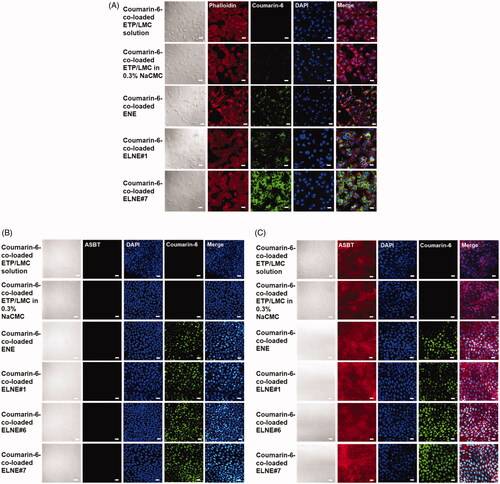 Figure 2. Confocal laser scanning microscopic images of the cellular uptake of different coumarin-6-co-loaded etoposide (ETP) vehicles. (A) Cellular uptake of coumarin-6-co-loaded ETP/LMC solution, coumarin-6-co-loaded ETP/LMC in 0.3% NaCMC, coumarin-6-loaded ENE and ELNE#1, and coumarin-6-loaded ELNE incorporating an ionic complex of Nα-deoxycholyl-l-lysyl-methylester and 1,2-didecanoyl-sn-glycero-3-phosphate (sodium salt) (ELNE#7) by Caco-2 cells. Cellular uptake of coumarin-6-co-loaded ETP/LMC solution, coumarin-6-co-loaded ETP/LMC in 0.3% NaCMC, coumarin-6-loaded ENE and ELNE#1, and coumarin-6-loaded ELNE incorporating an ionic complex of Nα-deoxycholyl-l-lysyl-methylester and 1,2-didecanoyl-sn-glycero-3-phosphate (sodium salt) (ELNE#6 and #7) by (B) MDCK cells or (C) ASBT-transfected MDCK cells. Scale bar, 20 µm.
