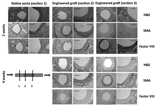 Figure 4 Histology of silk tube graft 2 weeks and 4 weeks post-implantation. Full cross-sections were taken at 2 weeks and 4 weeks post-implant for the native aorta (section 1, close to the interface with the silk tube) and at two different positions along the implanted silk tube graft (section 2 and section 3), as shown on the schematics. Blood flow is from left to right. Adjacent histological sections were stained for hematoxilin and eosin (H&E), smooth muscle actin (SMA) and Factor VIII at both time points. All images are shown in low and high magnification. After 2 weeks, silk grafts were patent with evidence of neointimal hyperplasia (see 2-week histologies of section 2) and a confluent endothelium (see 2-week histologies of section 3). After 4 weeks, these changes were less pronounced and tissue remodeling has taken place (see 4-week histologies of sections 2 and 3). All scale bars are 200 µm.