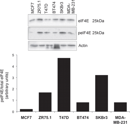 Figure 2 eIF4E expression and phosphorylation in breast cancer tissue. Cells in exponential growth phase were lysed 24 h after the application of fresh medium. Proteins were separated by SDS-PAGE and western blots probed with antibodies to MNK1, eIF4E and serine 209 phosphorylated eIF4E. Figure representative of two independent blots. Quantitation is as per Figure 1.
