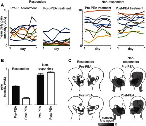 Figure 1 Subject psychophysics. (A) Daily pain intensity ratings in each of the 22 patients pre-palmitoylethanolamide (PEA) treatment and post-PEA treatment separated into responders (>20% pain reduction) and non-responders (<20% pain reduction). Pain intensity was rated three times daily on a 10 cm VAS; (B) mean (±SEM) pain intensity ratings pre- and post-PEA in the responder (n=11) and non-responder (n=11) groups; (C) areas of ongoing pain pre- and post-PEA in the responder and non-responder groups.