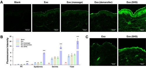 Figure 4 Effects of SHSs on the skin penetration of hucMSC-Exos in vitro and in vivo. (A) Penetration of fluorescent protein dye-labeled hucMSC-Exos (green) through porcine skin after 2-min massage by an electrical massager, 2-min application of a dermaroller, treatment of SHSs via 2-min massage by an electrical massager, and no treatment, respectively. The untreated skin was used as the blank to assess the autofluorescence of skin. (B) Deposition of dye-labeled hucMSC-Exos in each layer of skin. (C) Penetration of fluorescent protein dye-labeled hucMSC-Exos (green) through mouse skin treated with SHSs or untreated in vivo. All data were expressed as mean ± SD (n = 3). ***p < 0.001, versus the untreated exosome group.