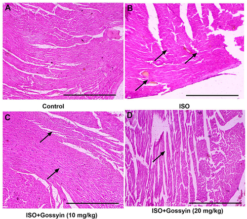 Figure 13 Effect of Gossypin on the histopathology of ISO induced MI rats. (A) Normal control, (B) ISO control, (C) ISO+Gossypin (10 mg/kg) and (D) ISO+Gossypin (20 mg/kg). All group contains 6 rats.