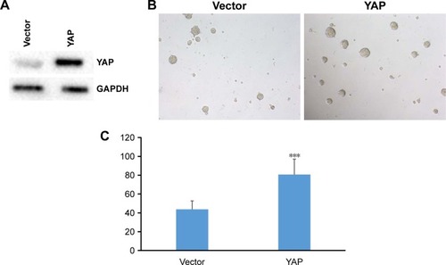 Figure 4 YAP promotes self-renewal properties of bladder cancer stem cells.