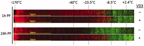 Figure 4. Prostate cancer TEM model results of a 5 min cryosurgical procedure with a supercritical nitrogen device. For VD3 + samples, pTEMs were pretreated for 24 h with 50 nM calcitriol prior to the freeze exposure. TEM samples were frozen, allowed to thaw and assessed for viability 1 h or 24 h post freeze using Calcein-AM (green, live cells) and propidium iodide (red, dead cells). Images depict the center of the freeze zone (left side) to the iceball edge and non-frozen section (right side). Temperature during freezing were monitored with embedded thermocouples during the freeze and end point temperatures at their respective position in the samples are indicated. At 1 h post-freeze, both freeze only and VD3/freeze samples reveal cellular damage out to ∼−10 °C. At 24 h, in the freeze only samples most of the cells in the −10 °C to −25 °C region recovered revealing complete cell death below ∼−30 °C. In VD3/freeze samples, cellular recovery was significantly reduced resulting in complete cell destruction below ∼−10 °C.