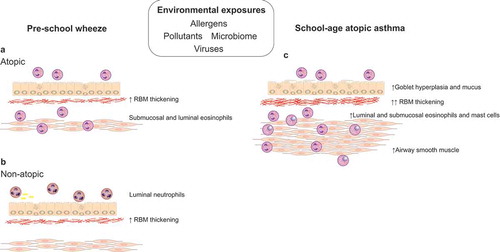Figure 1. Pathology of preschool wheeze and school-age allergic asthma