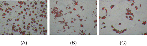 Figure 6.  Effect of WECML on the adipogenic differentiation of BMSCs. The BMSCs were plated in 48-well culture plates, after being induced by adipogenic supplement (10 μg/mL insulin, 10−7 M dexthamethone) and treated with WECML at final concentrations of 0.1 and 100 μg/mL. The adipocytes from BMSCs were fixed in 4% formaldehyde, washed with water and stained with a 0.6% (w/v) oil red O solution (60% isopropanol, 40% water) for 15 min at room temperature. Then cell monolayers were washed extensively with water to remove unbound dye, and recorded by inverted phase contrast microscopy (Olympus IX 51). (A) adipogenic supplement, (B) adipogenic supplement + 0.1 μg/mL WECML, (C) adipogenic supplement + 100 μg/mL WECML.