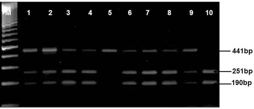 Figure 1 Amplified and digested PCR product of TGF-β1 (509-C/T) gene. Lane M: 100 bp DNA marker, Lanes 1, 2, 3, 4, 6, 7, 8, 9: heterozygous genotypes (CT: bands of 441, 251, and 190 bp), Lane 5: homozygous mutant (TT: uncut DNA of 441 bp), and lane 10: wild type genotype (CC: bands of 251 and 190 bp).