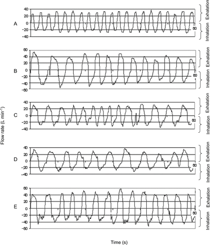 FIGURE 3 The exercise-specific breathing patterns recorded by the Breathing Recording and Simulation System from a selected subject exhibiting QMIF closest to the average values calculated for 25-subject panel: normal breathing (A), deep breathing (B), head side-to-side (C), head up and down (D), bending over (E).
