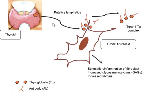 Figure 1 Hypothetical role of thyroglobulin in Graves’ ophthalmopathy.