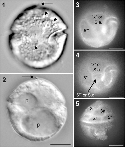 Figs 1–5. Single cell of Herdmania litoralis used for SSU and LSU rDNA sequencing, DIC optics (1, 2) and fluorescence microscopy (3–5). 1, 2. Two focuses showing the incomplete cingulum, apical hook-like notch (arrow), globules (arrowheads) and two pusules (p). 3. Ventral view, showing the hexagonal ‘x’ plate (or S.a. plate). 4. Ventral view, showing the four-sided 6′′′ plate (or S.d. plate). 5. Dorsal view. Labels: 4′′ and 5′′, precingular plates; 3a, third anterior intercalary plate; 5′′′ and 6′′′, postcingular plates. Scale bars: 10 µm.