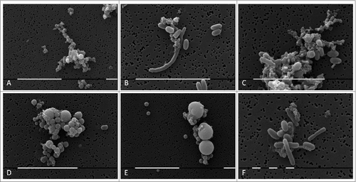 Figure 3. SEM of huge filamentous and membranous L-type formations with many small granular, oval or coccoid cells fit together (A-E) and tightly packed rods (F) from blood isolate No1 grown in semisolid agar during the second phase/week of cultivation. Bars: 100 μm (D); 10 μm (A, B, E, F).