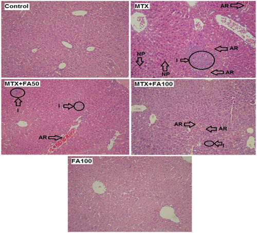 Figure 6 The effect of normal saline, methotrexate, methotrexate + ferulic acid and ferulic acid administration on liver (stained with hematoxylin & eosin, magnification X 100). (Control), normal saline-treated mice showing normal morphological appearance; (MTX), methotrexate-treated mice showing massive accumulation of RBCs, accumulation of inflammatory cells and nuclear pyknosis; (MTX and FA) methotrexate + ferulic acid at doses (50 and 100 mg/kg) treated mice, showing mild hepatic accumulation of RBCs inflammatory cells, (FA) ferulic acid at dose 100 mg/kg treated mice showing normal morphological appearance similar to the control group. Arrows indicates NP: Nuclear pyknosis and AR: Accumulation of red blood cells, Circles indicates I: Inflammatory cells.