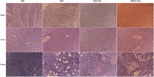 Figure 5. Typical histopathologic images of rat hearts, livers, and tumors after treatment in H22-bearing mice with PSSV-NPs and MPSSV-NPs group for 10 days (H&E staining, ×20).