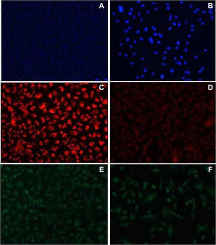 Figure 7 Images observed for AgNPs treated cells under phase contrast microscope after 48 hrs of treatment for DAPI staining (A) control (B) treated cells; for Mito Tracker Red staining (C) control (D) treated cells and for DCFDA staining (E) control (F) treated cells.
