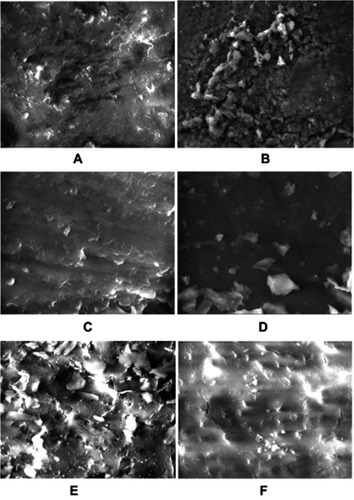 Figure 3 Comparison between irrigants cleansing ability: (A) Nano CHX laser activation, (B) CHX laser activation, (C) Nano CHX PUI, (D) Nano CHX No activation, (E) CHX No activation and (F) CHX PUI activation.