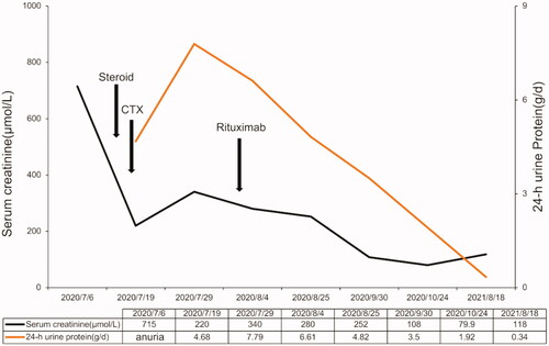 Figure 4. The patient’s treatment follow-up chart. The chart includes the time and dose of the patient’s steroid use and the timing of the use of immunosuppressants and the alterations of clinic parameters including urine protein and serum creatinine during the treatment.