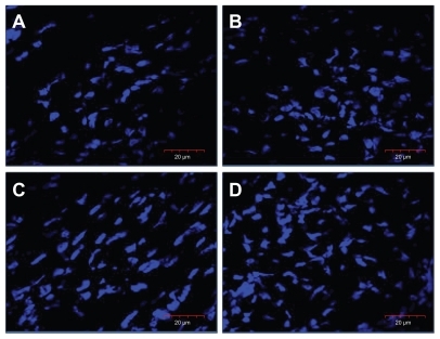 Figure 2 Images of nuclei (blue), stained with 4′,6-diamidino-2-phenylindole, in the cross-section of the breast muscle of a chicken embryo on day 20 of incubation visualized using a confocal microscope. (A) Control, (B) gold nanoparticles, (C) heparan sulfate, and (D) gold nanoparticles and heparan sulfate complex.