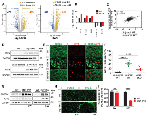 Figure 3. Axonal injury responses in the DRG neurons of Avil-atg7-cKO mice without nerve injury. (A) mRNA-seq analysis of DRG. The volcano plots showing Atg7-DEG (DEG) and RAG. DEG; differentially expressed genes (2-fold, p < 0.05) in Avil-atg7-cKO DRG compared to WT DRG without nerve injury, RAG; regeneration-associated genes (2 fold, p < 0.05) identified at 7 days after nerve injury in the DRG of WT mice. (B) RT-qPCR results of 5 Atg7-DEGs those expression changes were compared with mRNA-seq results. (C) Pearson’s correlation coefficient analysis between the fold changes of whole transcripts in uncut Avil-atg7-cKO DRG/uncut WT DRG and injured WT DRG/uncut WT. r = 0.56, p < 0.0001. (D) Western blot analysis showing ATF3 induction in the DRG of WT, Avil-atg7-cKO and SYN1-atg7-cKO mice in adults. (E, F) IF staining against ATF3 in the DRG of WT, injured WT and uninjured Avil-atg7-cKO mice in adults. Scale bar: 50 μm. (F) Quantification of ATF3 (+) DRG neurons. (G) Western blot analysis of ATF3 in the DRG of WT and Avil-atg7-cKO mice at 1 week and 3 weeks after birth. (H) IF staining against parvalbumin in the sciatic nerves of WT and Avil-atg7-cKO mice at 1 week and 3 weeks after birth. (I) Quantification of the number of parvalbumin (+) axons in the sciatic nerve. ****; p < 0.0001. ns; non-significant. Scale bar: 50 μm.