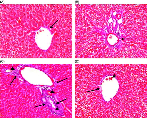 Figure 2. Effect of cod liver oil on sodium nitrite-induced drainage of connective tissue. Liver sections from different rat groups were stained with Mallory trichome and examined under a microscope (400 × magnification). (A) Sections from control group showing minimal amount of collagen fibers around the central vein (arrow). (B) Sections from treated control group showing minimal amount of collagen fibers in the portal tract (arrow). (C) Administration of sodium nitrite increased amount of collagen fibers surrounding a central vein (arrows). Delicate collagen fibers appear in the sinusoidal wall (arrow head). (D) Sections from rats treated with cod liver oil showing minimal collagen fibers surrounding a central vein (arrow) with an area exhibiting some increased fibers (arrow head).