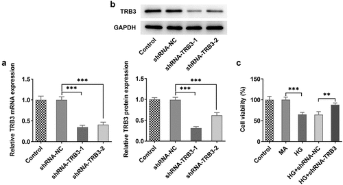 Figure 2. TRB3 depletion alleviates HG-triggered hRPE cell impairment. The transfection efficiency of shRNA-TRB3-1/2 plasmids was tested by (a) RT-qPCR and (b) western blot. (c) The impacts of TRB3 silencing on the viability of HG-treated hRPE cells were appraised by CCK-8 assay. **P < 0.01, ***P < 0.001. TRB3, Tribbles homolog 3. MA, mannitol. HG, high glucose.