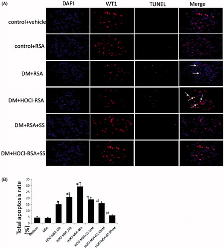 Figure 3. (A) SS-31 attenuated podocyte apoptosis in diabetic rats injected with native RSA or HOCl-RSA. (B) HOCl-MSA induced apoptosis time-dependently prevented by SS-31 in cultured podocytes. Data are expressed as Mean ± SD. ANOVA, p < .05. *p < .05 vs Medium and MSA; ＃p < .05 vs Group HOCl-MSA 48h.
