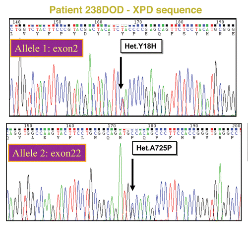 Figure 3. ERCC2/XPD sequence analysis of TTD238DOD Relevant parts of peak plots from standard capillary sequencing analysis of TTD238DOD fibroblast DNA. The patient is a compound heterozygote for two mutations. Top: XPD exon 2, bottom XPD exon 22.
