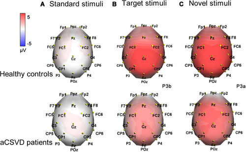 Figure 4 The above figure shows the topographical voltage distribution of P3 in aCSVD patients and healthy controls (red indicates positive potential and blue indicates negative potential). (A) standard stimulus was 400–430ms; (B) target stimulus was 430–450ms; (C) new stimulus was in 400–440ms.