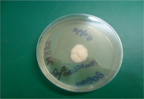 Figure 6 Trichophyton violaceum waxy colony (white variant).