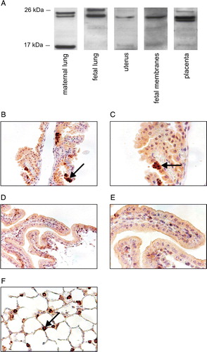 Figure 3.  SP-C proprotein is present in mouse gestational tissues. A: In Western analysis different amounts of protein from PBS-treated mice were used (maternal lung 10 µg, fetal lung 20 µg, and uterus, fetal membranes, and placenta 50 µg collected at 17 dpc). The proteins were detected using proSP-C antibody FL-197. B–F: Immunohistological localization of proSP-C in fetal membranes (B–E) and maternal lung at 17 dpc (F); tissue sections from either PBS treated wild-type (B, C, and F) or Sftpc −/− (D, E) mouse stained with proSP-C antibody (WRAB-SP-C). Original magnifications in panels B, D, and F are×20 and in panels C and E×40. Positive staining in epithelial yolk sac cells (B and C) and in alveolar type II cells (F) is indicated by arrows. SP-C: surfactant protein C, PBS: phosphate-buffered saline, SFTPC, SP-C gene.