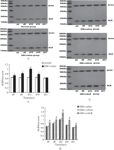 Figure 1E–H. Western blot and corresponding densitometric analyses were employed to analyze ALR expression in renal tissue (E, G). The data are shown as the mean ± SEM of five independent experiments (F, H). *p < 0.05 vs. the normal group, #p < 0.05 vs. the vehicle group.