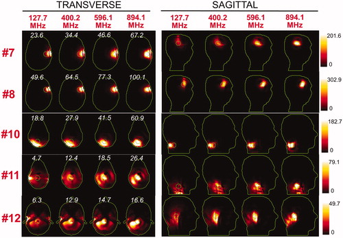 Figure 6. SAR maps (in W/kg) associated to the uSAF treatment for tumours #7–#12 at frequencies 127.7, 400.2, 596.1 and 894.1 MHz in both the transverse and sagittal views. Tumour #9 is not shown since the SAF did not converge to the ultimate value for this tumour location. Contours of the head and the tumour are shown in green. The white numbers indicate the uSAF for each tumour location and frequency simulated. USAFs are computed for the whole head and are, therefore, the same for the transverse and sagittal views.