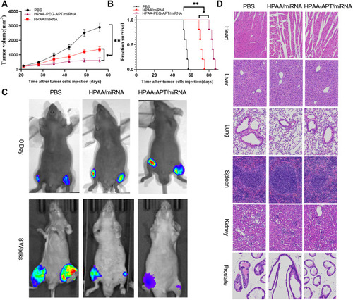 Figure 6 In vivo treatment efficacy of HPAA complexes. (A) Tumor growth curve in the different groups. (B) Cumulative survival outcome of in the various treatment groups. (C) Representative bioluminance signal of bone metastasis of a mice at various treatment groups after 8 weeks. (D) representative HE staining of organ histology at various treatment groups. Scale bars:100μm. *p<0.05, **p<0.05.