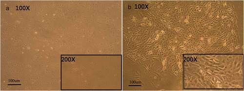 Figure 2. Morphology of cultured H9 human embryonic stem cells. hESCs induced by RA, BMP4, and AA appear similar to keratinocytes (B), cells cultured without RA, BMP4, and AA are fusiform in appearance (A).