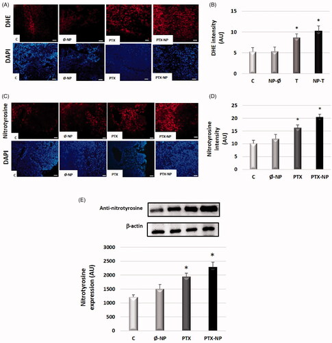 Figure 6. Paclitaxel-loaded nanoparticles increase levels of oxidative and nitrosative stress in the HNSCC mice model. Experimental groups: C (control); Ø-NP (unloaded NPs, 1 mg/ml; PTX (Paclitaxel, 5 mg/kg); and PTX-NP (Paclitaxel loaded NPs, 5 mg/kg for 21 days. (A) Superoxide anion detection with the fluorescent probe dihydroethidium in red (DHE) and DAPI in blue dye in tumor tissue, (x40). Scale bar 100 mm. (B) Quantification of fluorescence intensity for DHE by ImageJ software. (C) Representative immunostaining of nitrotyrosine in tumor tissues. The cytoplasm shows nitrotyrosine-positive staining (red), (x40). Scale bar 100 mm. (D) Nitrotyrosine immunofluorescence intensity was analyzed by ImageJ software. (E) Quantification of nitrotyrosine detected in the blots using densitometry analysis. Data represent the mean ± SD of arbitrary units (AU). *p < .05 versus C and Ø-NP groups; (n = 20).