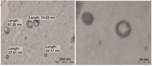 Figure 2. Transmission electron microscope photographs of (T3) Tenoxicam-loaded ultradeformable vesicles (magnification × 100,000).