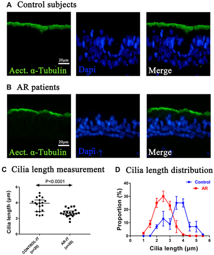 Figure 1 Shorter cilia length in patients with AR compared with control individuals. (A and B) Positive staining of cilia by acet.α-tubulin in patients with AR compared with control individuals under 400× magnification, scale bar 20 µm. Green – acet.α-tubulin, blue – DAPI. (C) Shorter cilia length in patients with AR compared with control individuals. Median and first and third quartile values are indicated by the scale bar. (D) A higher proportion of shorter cilia length distribution in patients with AR.
