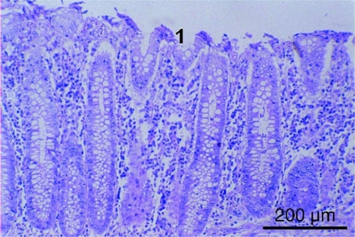 Figure 12 Flattening of superficial epithelium (1) in colon mucosa in IBS patient (hematoxylin-eosin staining, bar = 200 μm).