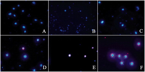 Figure 4. Fluorescence photomicrographs of Hoechst33258 and propidium iodide double staining after 24 h transfection: (A) normal C6 cells, (B) the cells incubated with Lipofectamin 2000 only, (C) the cells transfected with empty siRNA vector, (D) the cells transfected with c-Myc-siRNA1-pDNAs, (E) the cells transfected with c-Myc-siRNA2-pDNAs, and (F) the cells transfected with c-Myc-siRNA3-pDNAs.