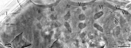 Figure 3. Bryodelphax beniowskii sp. nov.: ventral plates. Roman numerals indicate the rows in which the ventral plates are arranged, arrows indicate patches of granulation around gonopore (holotype). Scale bars in [μm]. PCM.