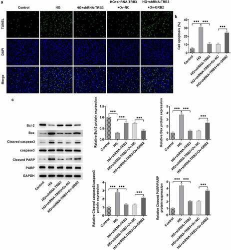 Figure 8. TRB3 affects HG-mediated hRPE cell apoptosis by binding with GRB2. (a) TUNEL assay estimated the apoptosis of HG-stimulated hRPE cells and (b) the quantification. (c) The protein levels of apoptosis-related factors were analyzed by western blot. ***P < 0.001. TRB3, Tribbles homolog 3. MA, mannitol. HG, high glucose. GRB2, growth factor receptor-bound 2. Bcl-2, B cell lymphoma-2. Bax, BCL-2 associated X.