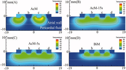 Figure 5. Temperature distribution in the atrial tissue after 60s or 120s of RF ablation across 5 mm wall thickness, considering four modes of ablation: (A) AcM, (B) AcM-15s, (C) AcM-5s and (D) BiM. The solid black line is the thermal damage border.