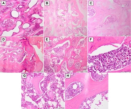 Figure 3 Histological slides showing hematoxylin and eosin staining of bone tissue.