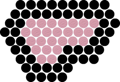 Figure 1. HIFU treatment planning showing the two circumferential treatment rings (black) and the deselected centre of the fibroadenoma (grey).