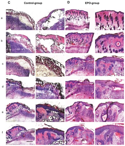 Figure 3 Representative hematoxylin and eosin stainings of scalded skin tissue samples from mice on day 7 after injury and continuous application of rhEPO or vehicle by subcutaneous injection. (A) Control group without EPO (vehicle only), mouse 1 (a–f); (B) EPO group, mouse 2 (a–f) on day 14; (C) control group, mouse 5 (a–f); (D) EPO group, mouse 8 (a–f). Magnification 40× or 100×, scale bar is 500 μm or 200 μm, respectively. In order to obtain a three-dimensional view of the wound area, each 100 μm thickness comparative slides were subjected to qualitative and quantitative evaluation. All evaluations were performed on hematoxylin and eosin routine stainings. The following histological parameters were examined and scored: wound closure in the form of assessment of remaining wound area and re-epithelialization (presence or absence of epithelial covering, degree of epithelial covering relative to number of epithelial cell layers as monolayer or multilayer designed, presence of conical structures). All criteria used for histological scoring of wound healing are summarized in Table 1. In order to render the observations comparable, sections every 100–200 μm in depth were evaluated at low-power (40×) and high-power magnification (100×).Notes: a–f: from a to b; b to c: c to d; d to e; e to f is a 100–200 μm distance of the cryosection.