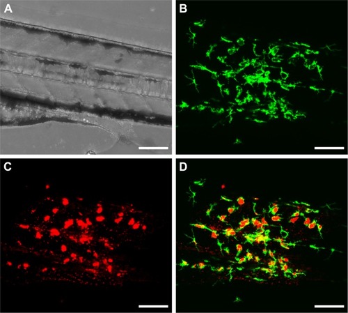 Figure 5 Co-localization of zebrafish macrophages and gelatin nanospheres in the muscle tissue surrounding the injection site at 24 hours after intramuscular injection of gelatin nanospheres into a 3-day-old zebrafish larva. (A) Bright field image; (B) green fluorescent macrophages; (C) red fluorescent gelatin nanospheres; (D) merged image of (B) and (C), with co-localization of macrophages and gelatin nanospheres depicted in yellow. The majority of the injected gelatin nanospheres was confined to the tissue area of injection and engulfed by macrophages, as shown in the merged image (D). Scale bars represent 100 μm.