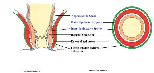 Figure 1 Schematic diagram showing intersphincteric and outer-sphincteric spaces.