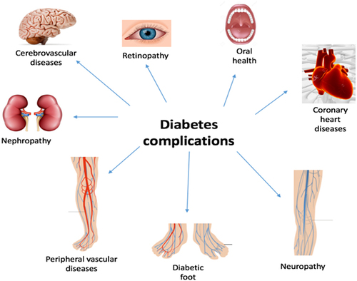 Figure 2 Shows major clinical complications of DM on different organs.