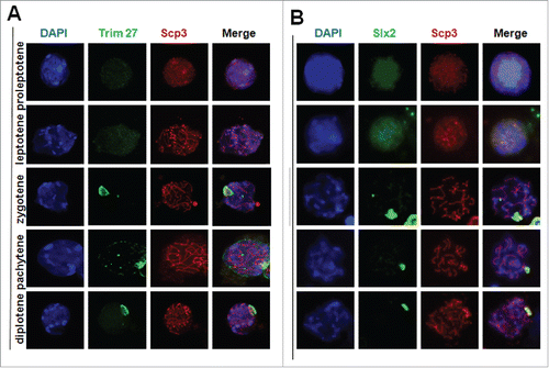 Figure 5. Immunostaining of testes chromosome spreads at the leptotene and diplotene stages for Trim27/SYCP3 and Slx2/Scp3. At the pachytene and diplotene stages, Trim27 and Slx2 are specifically restricted to XY bodies, and both proteins share a similar distribution pattern at the zygotene and diplotene stages. Interaction between Trim27 and Slx2 appears to occur in XY bodies, suggesting Trim27 is a linker protein that mediates the interaction between Slx2 and XY body proteins, and may therefore control XY body formation during meiosis. Images were captured using a laser confocal microscope. Bar = 5 µm.